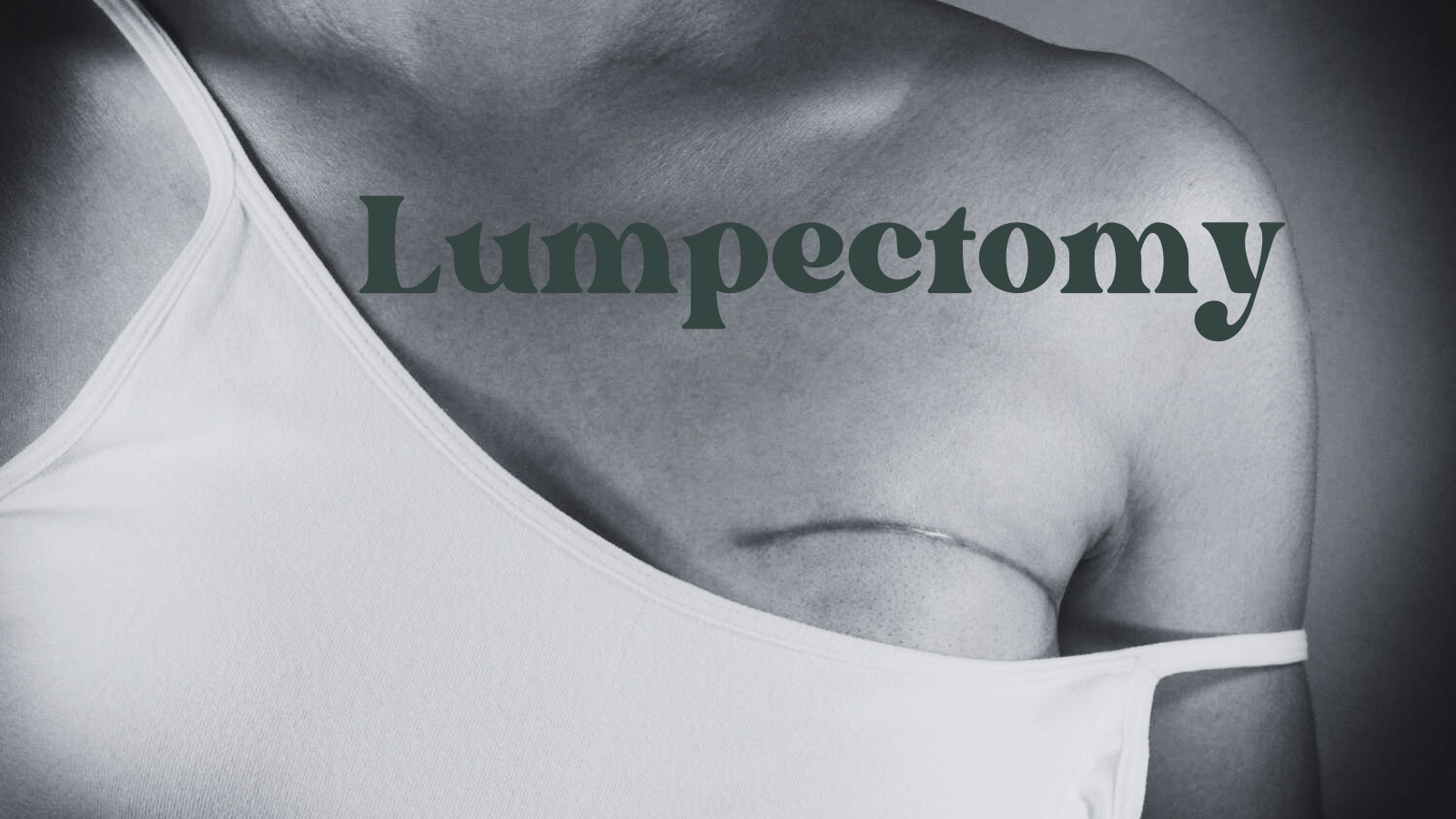 Lumpectomy 7 Powerful Facts You Must Know Today