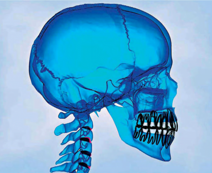 The eight bones that form the cranium shield the brain from injury.