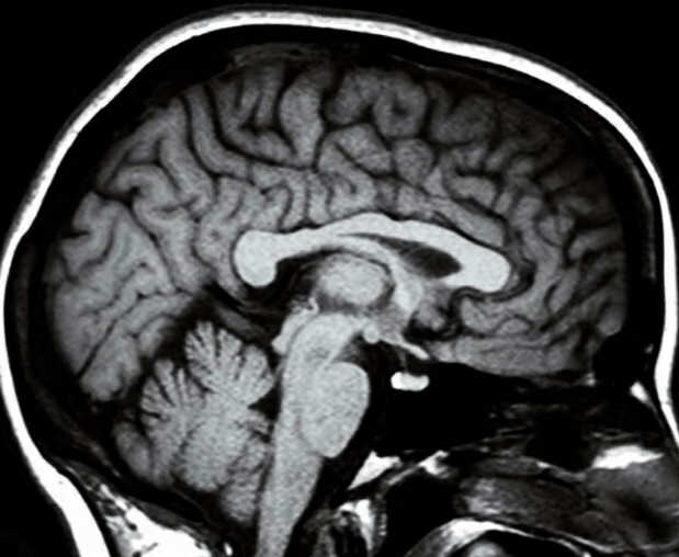 CT scans open windows into the brain's interior structure.