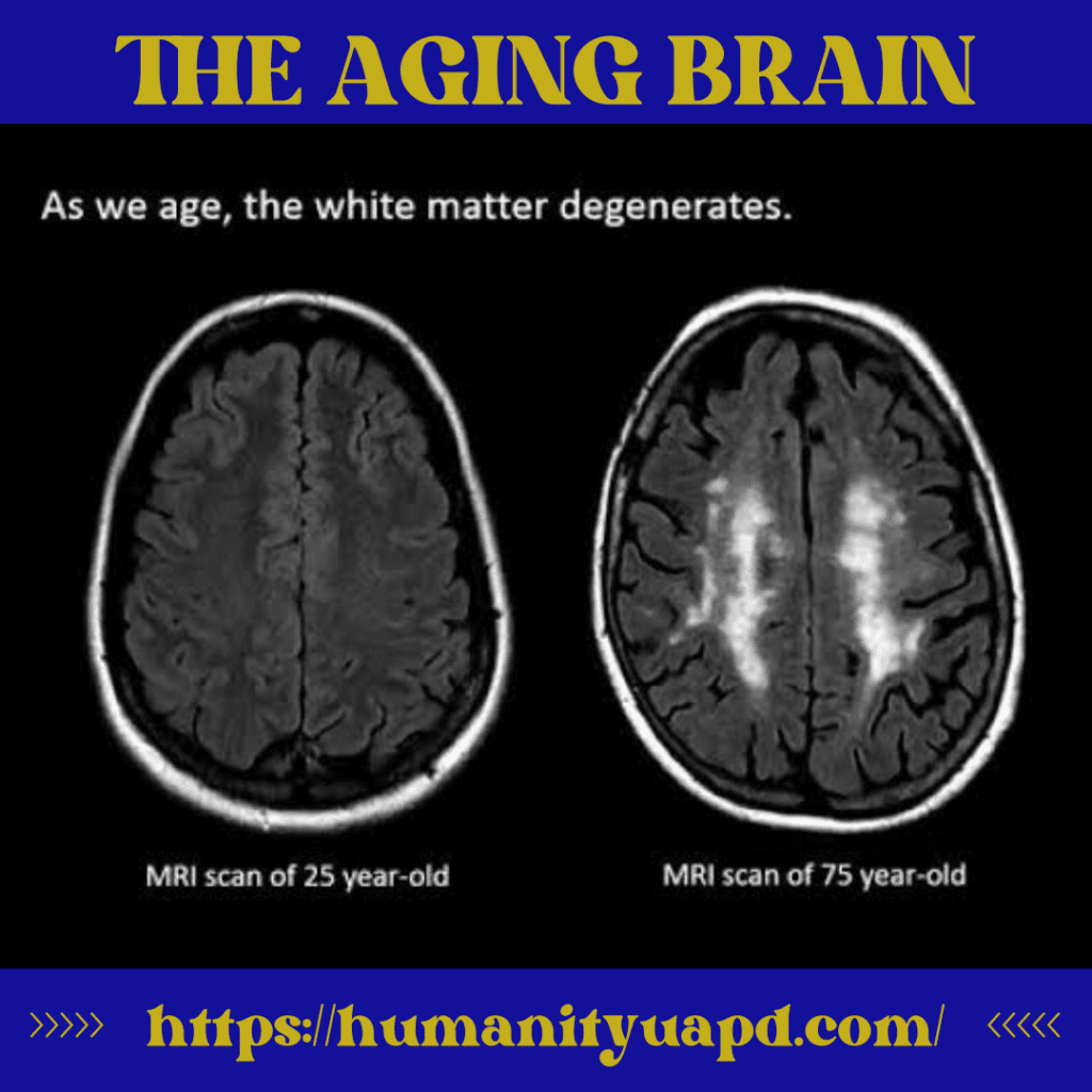 A MATURE VISION / THE AGING BRAIN 