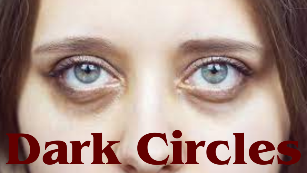 Understanding and Managing Dark Circles Under the Eyes: A Comprehensive Guide