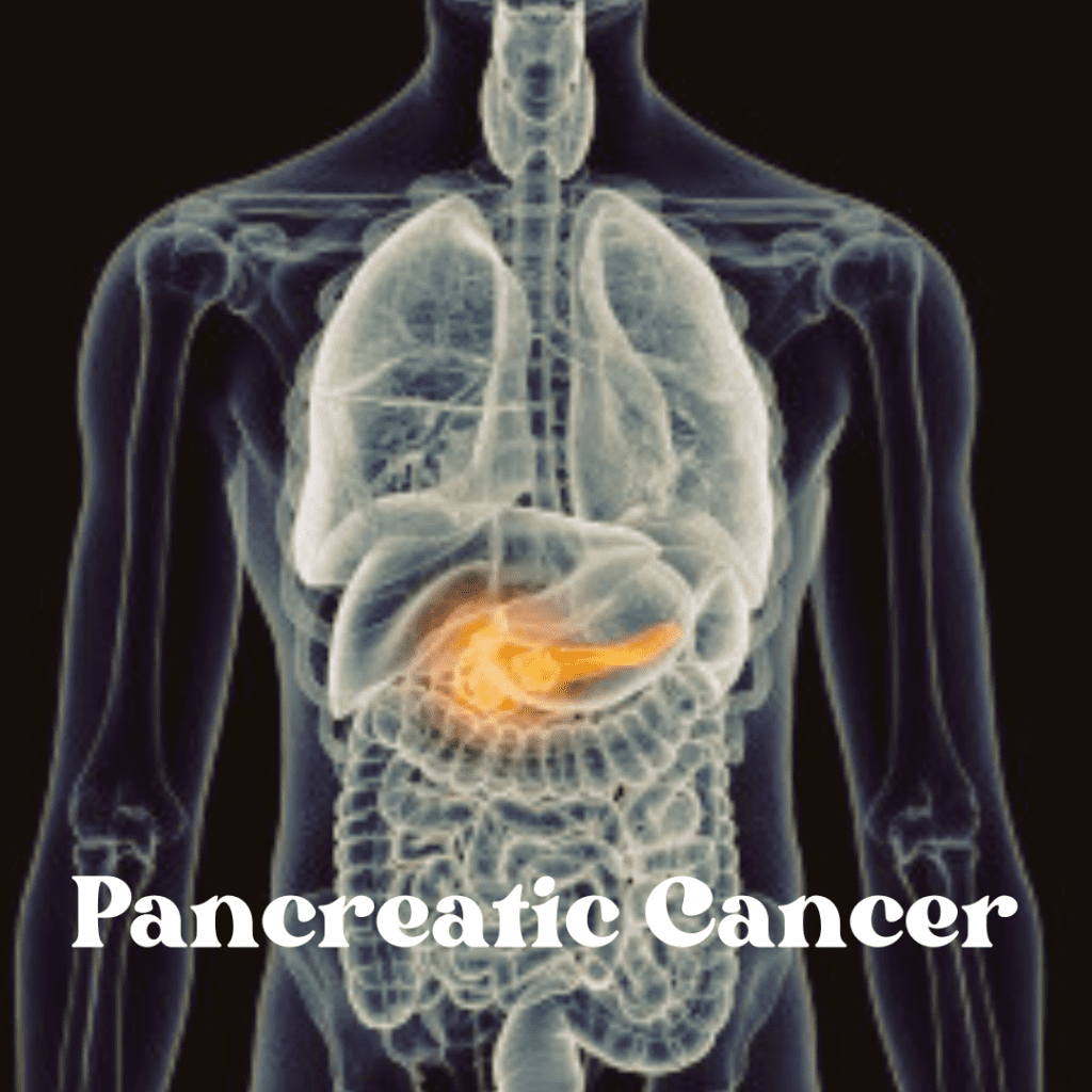 Pancreatic Cancer: Understanding Symptoms, Risk Factors, and Treatment Options