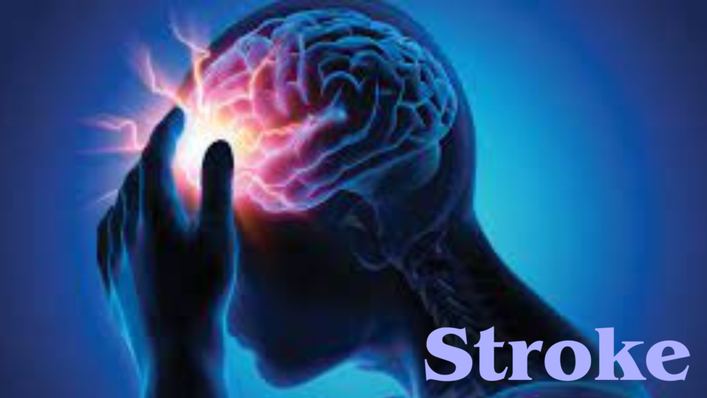 Understanding Stroke ( Brain Attack ) : Causes, Symptoms, and Prevention