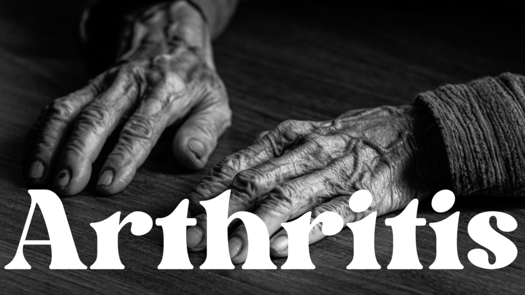 Understanding Arthritis: Causes, Types, and Treatment Options