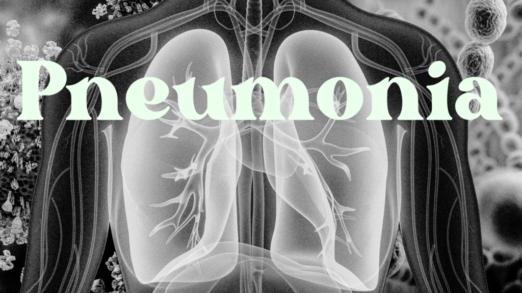Treatment of Pneumonia
