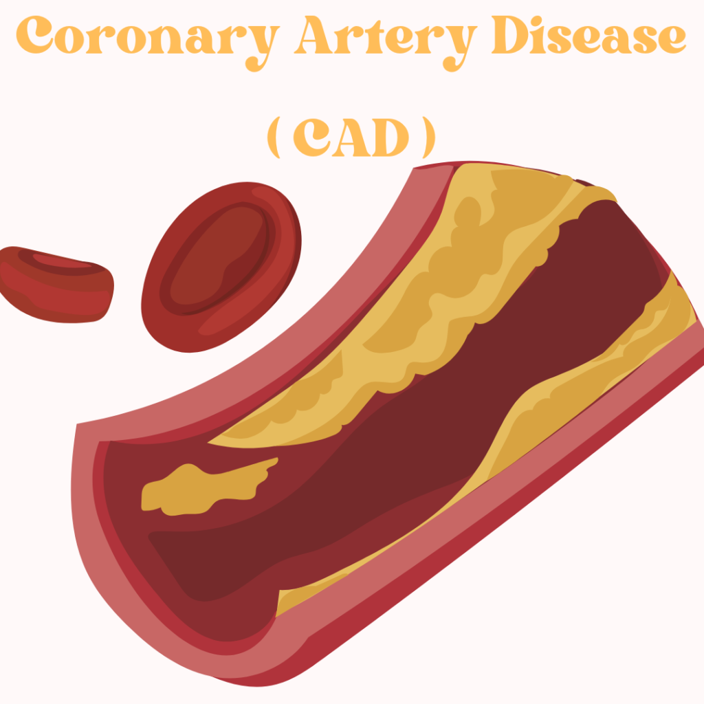 Coronary Artery Disease (CAD): Causes, Symptoms, and Prevention