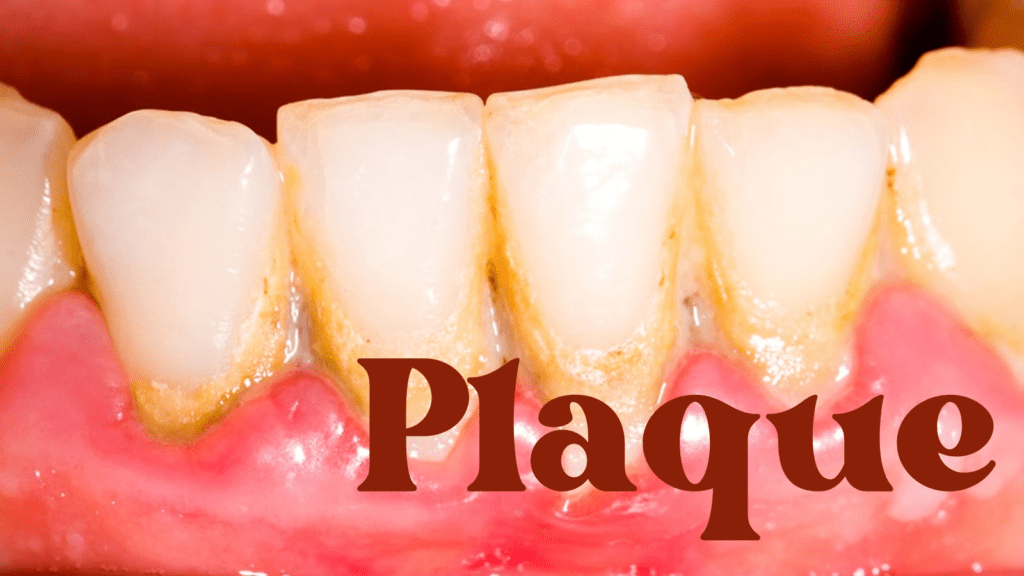 Plaque Health