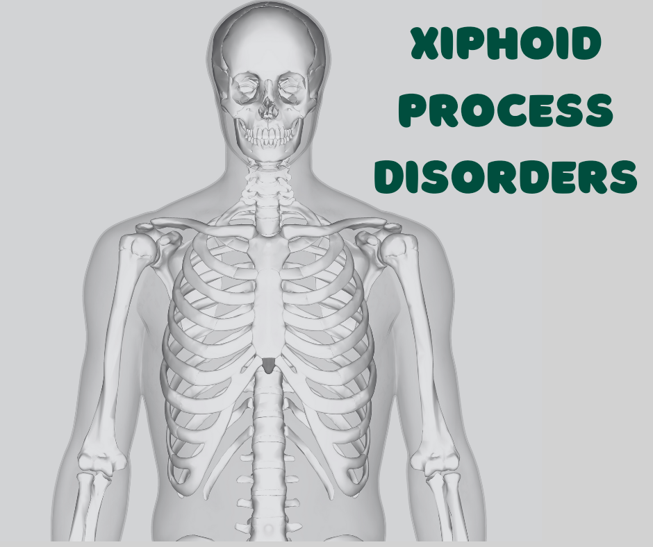 Xiphoid Process Disorders