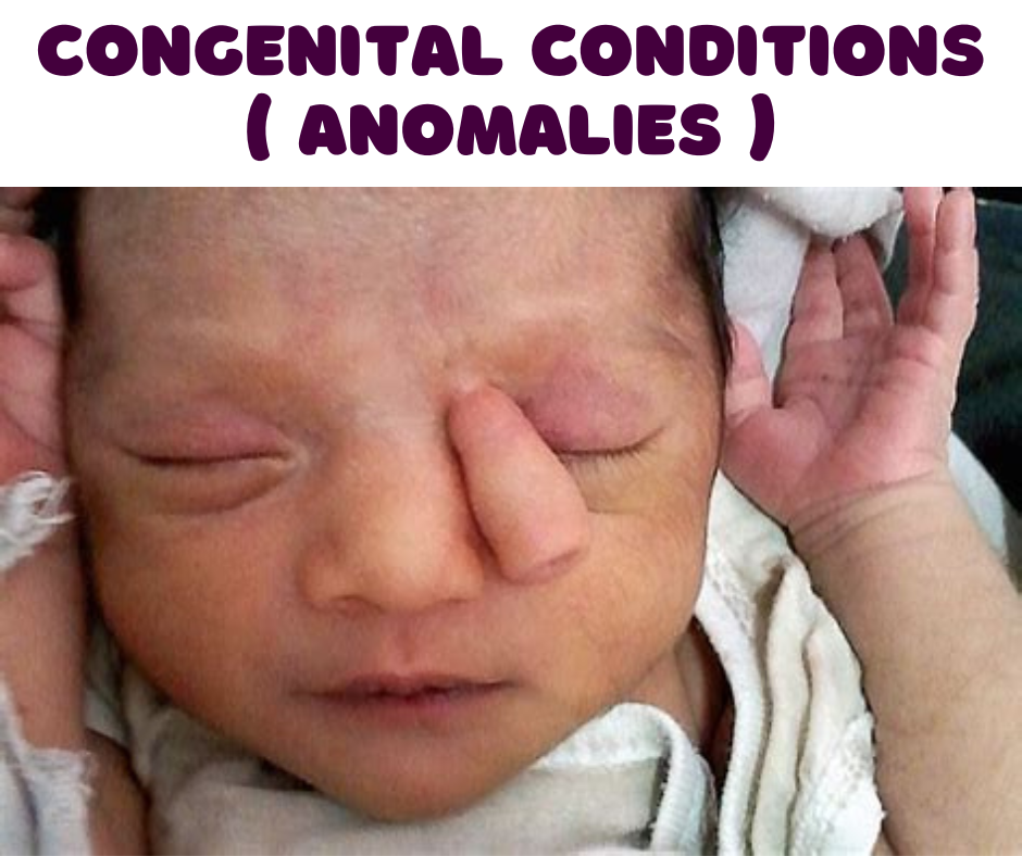 Congenital Anomalies 